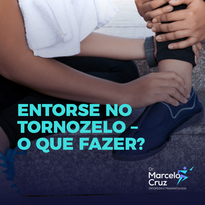 Entorse No Tornozelo O Que Fazer Dr Marcelo Cruz